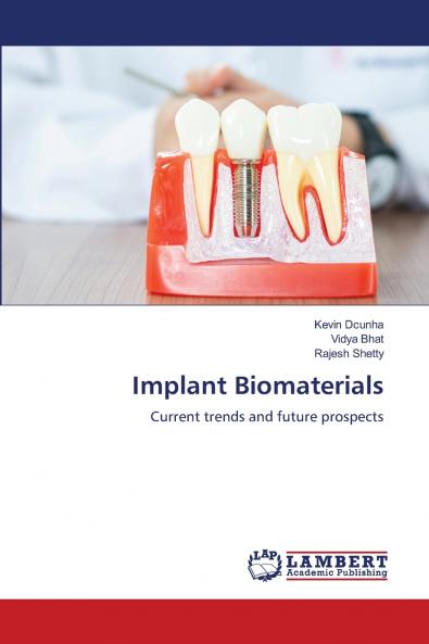 Implant Biomaterials