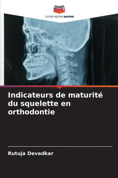 Indicateurs de maturité du squelette en orthodontie