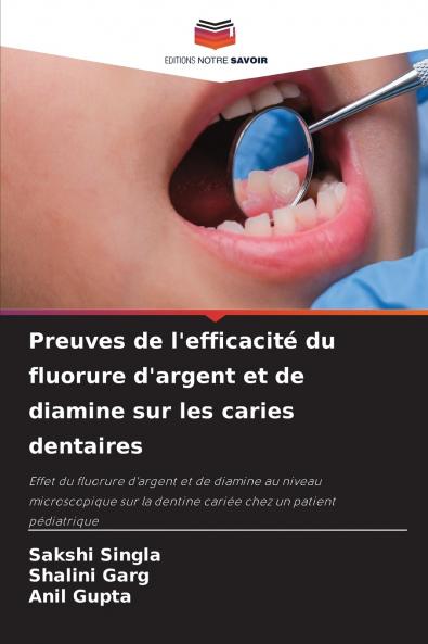 Preuves de l'efficacité du fluorure d'argent et de diamine sur les caries dentaires