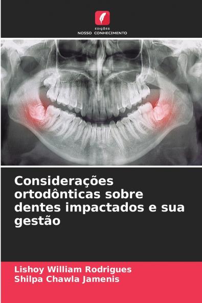 Considerações ortodônticas sobre dentes impactados e sua gestão