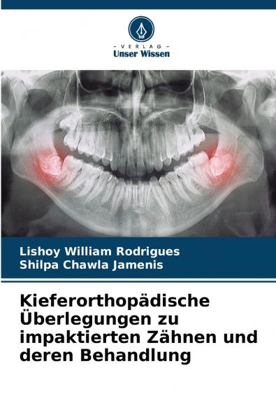 Kieferorthopädische Überlegungen zu impaktierten Zähnen und deren Behandlung