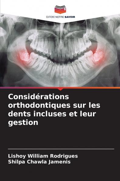 Considérations orthodontiques sur les dents incluses et leur gestion