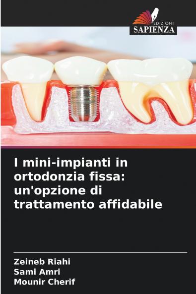 I mini-impianti in ortodonzia fissa
