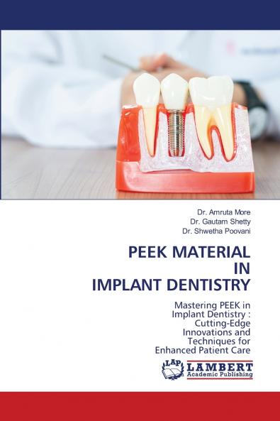 PEEK MATERIAL IN IMPLANT DENTISTRY