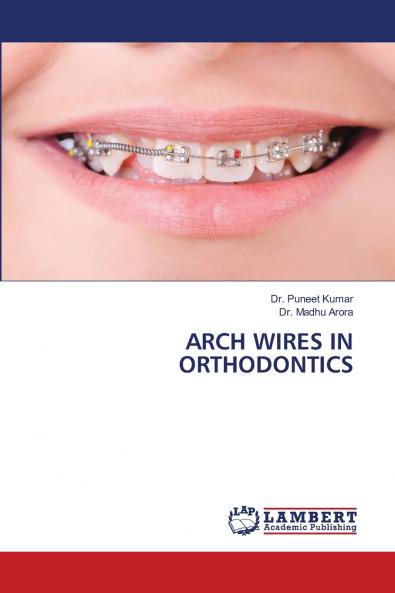 ARCH WIRES IN ORTHODONTICS