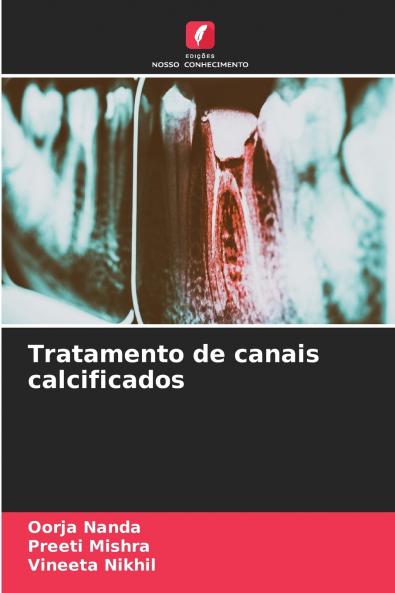 Tratamento de canais calcificados