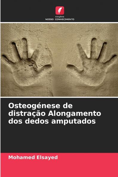 Osteogénese de distração Alongamento dos dedos amputados