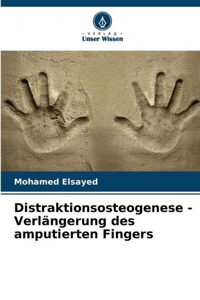 Distraktionsosteogenese - Verlängerung des amputierten Fingers