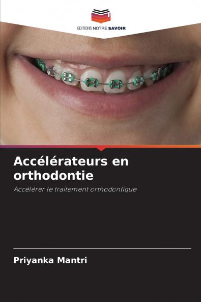 Accélérateurs en orthodontie