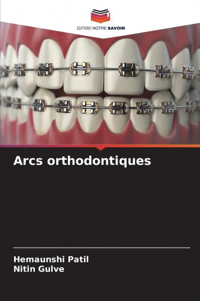 Arcs orthodontiques