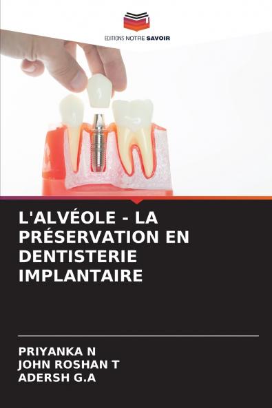 L'ALVÉOLE - LA PRÉSERVATION EN DENTISTERIE IMPLANTAIRE