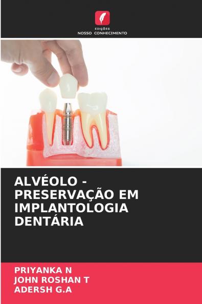 ALVÉOLO - PRESERVAÇÃO EM IMPLANTOLOGIA DENTÁRIA