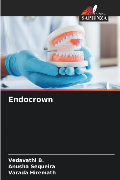 Endocrown