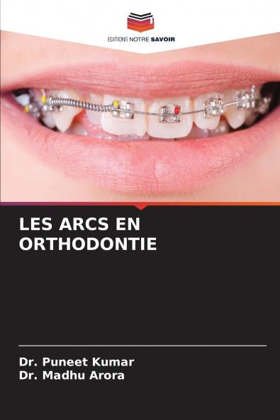 LES ARCS EN ORTHODONTIE