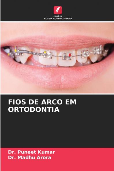 FIOS DE ARCO EM ORTODONTIA