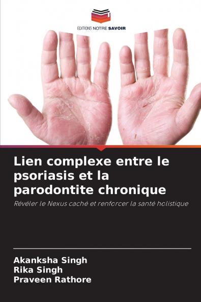 Lien complexe entre le psoriasis et la parodontite chronique