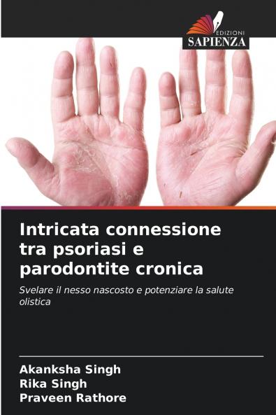 Intricata connessione tra psoriasi e parodontite cronica