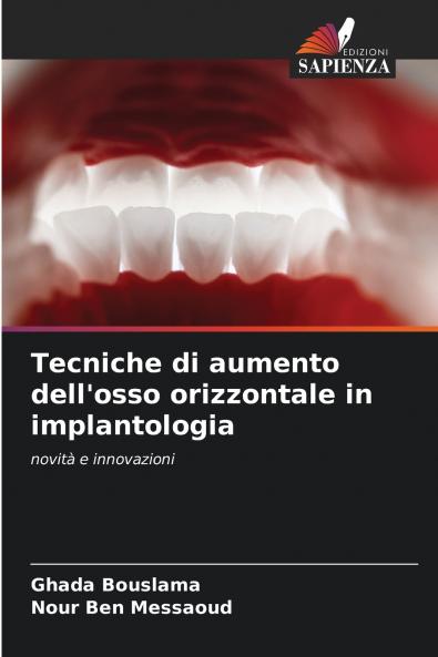 Tecniche di aumento dell'osso orizzontale in implantologia