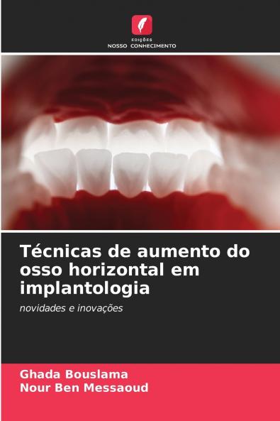 Técnicas de aumento do osso horizontal em implantologia