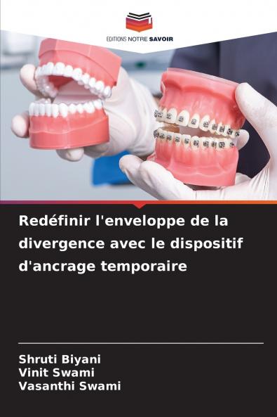 Redéfinir l'enveloppe de la divergence avec le dispositif d'ancrage temporaire