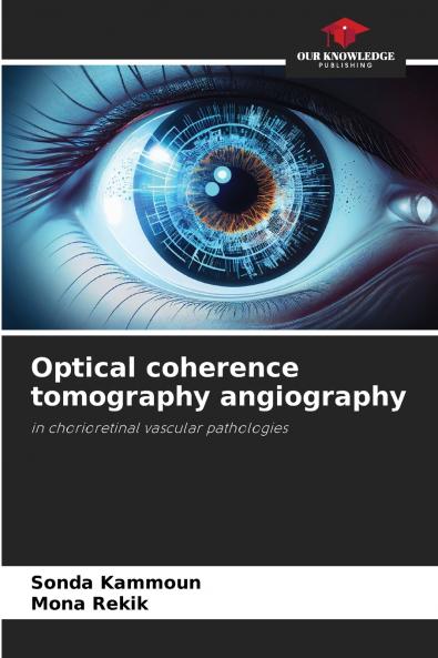 Optical coherence tomography angiography