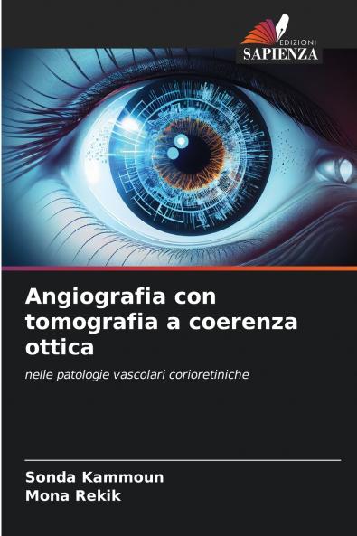 Angiografia con tomografia a coerenza ottica