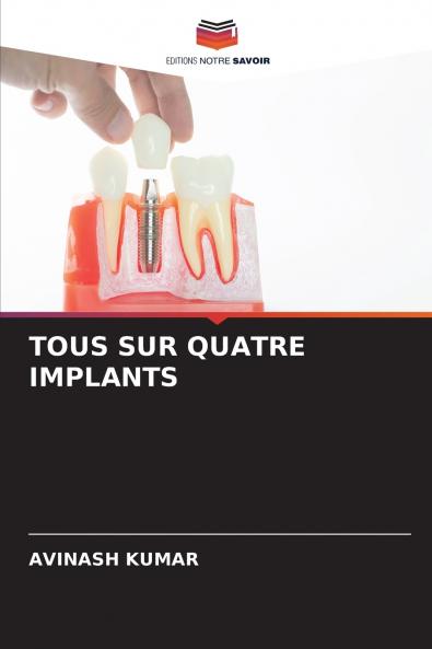 TOUS SUR QUATRE IMPLANTS