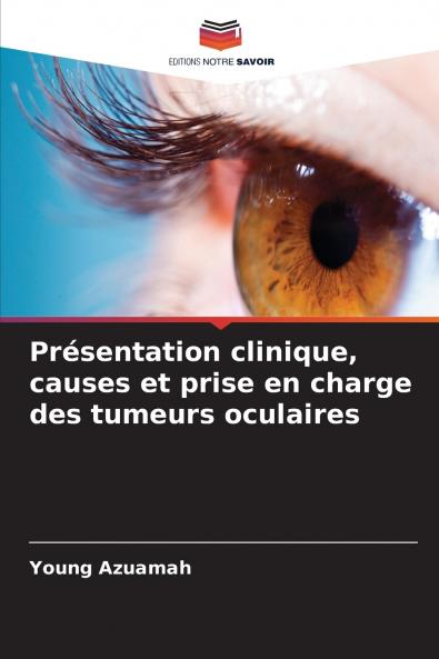 Présentation clinique causes et prise en charge des tumeurs oculaires