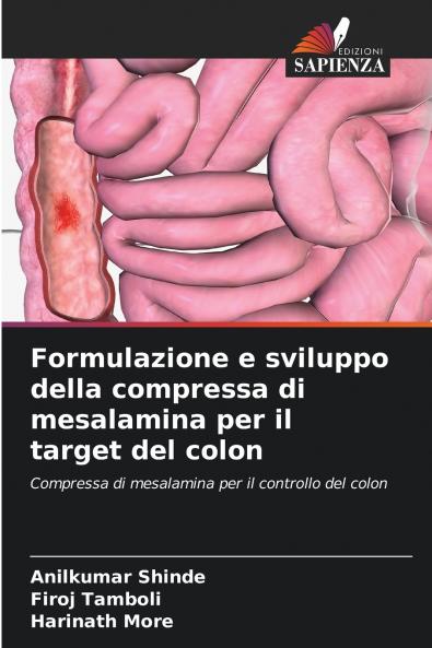 Formulazione e sviluppo della compressa di mesalamina per il target del colon