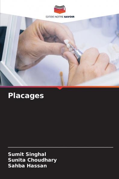 Placages