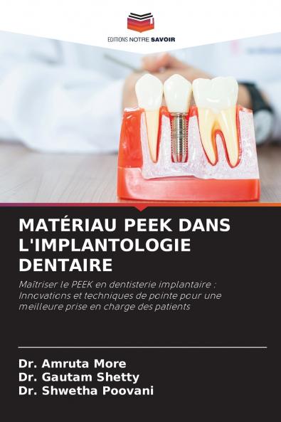 MATÉRIAU PEEK DANS L'IMPLANTOLOGIE DENTAIRE