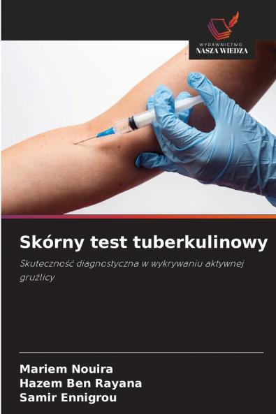Skórny test tuberkulinowy