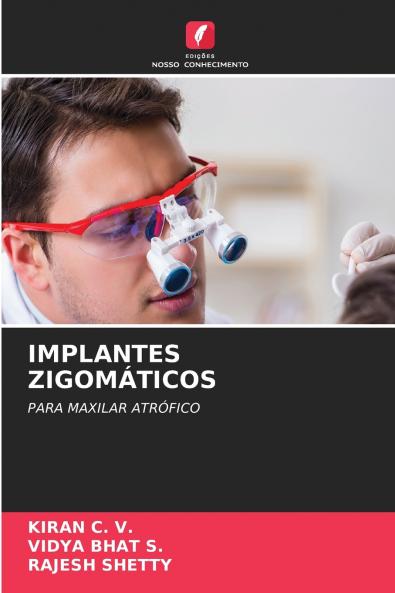 IMPLANTES ZIGOMÁTICOS