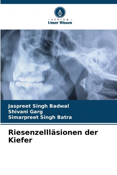 Riesenzellläsionen der Kiefer