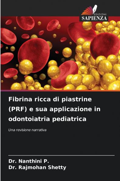 Fibrina ricca di piastrine (PRF) e sua applicazione in odontoiatria pediatrica