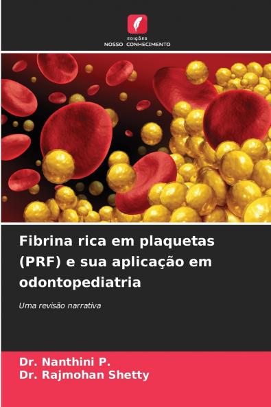 Fibrina rica em plaquetas (PRF) e sua aplicação em odontopediatria