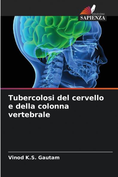 Tubercolosi del cervello e della colonna vertebrale