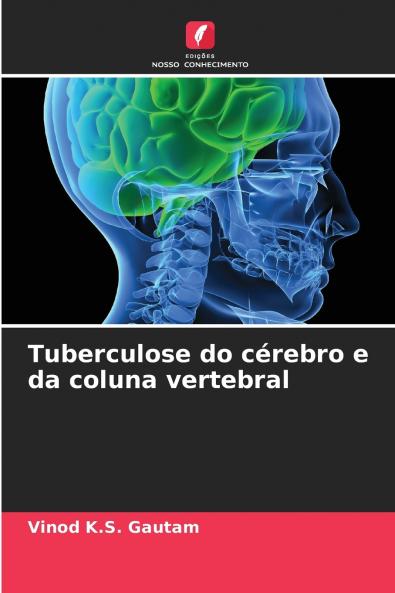 Tuberculose do cérebro e da coluna vertebral