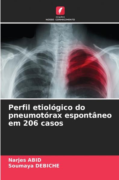 Perfil etiológico do pneumotórax espontâneo em 206 casos