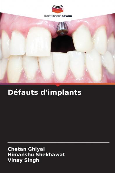 Défauts d'implants