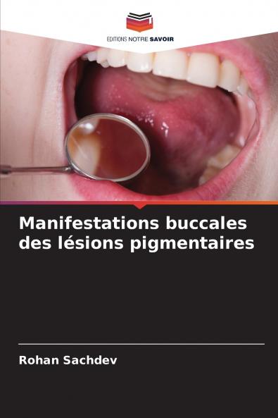 Manifestations buccales des lésions pigmentaires
