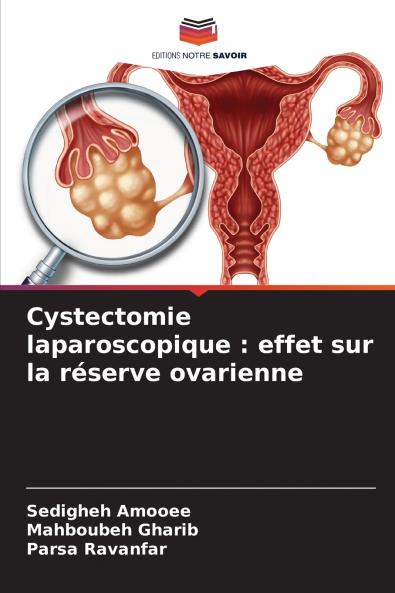 Cystectomie laparoscopique
