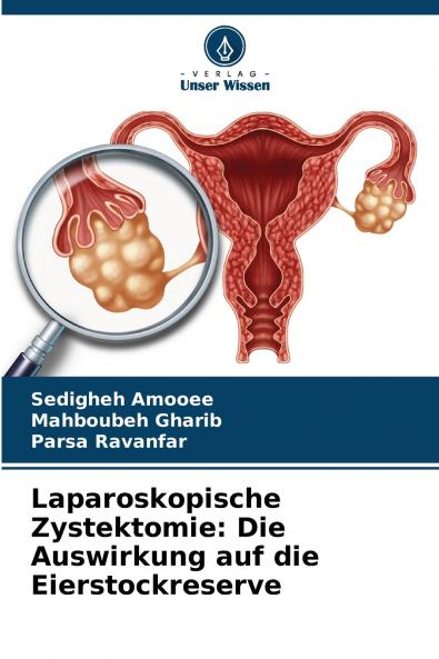 Laparoskopische Zystektomie