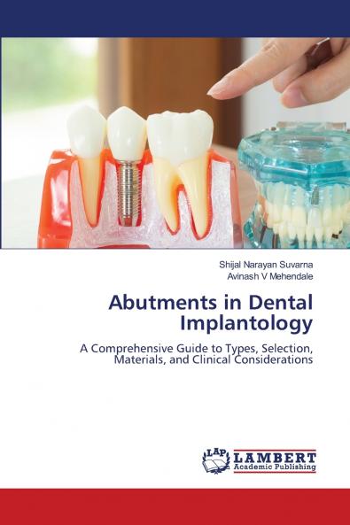 Abutments in Dental Implantology