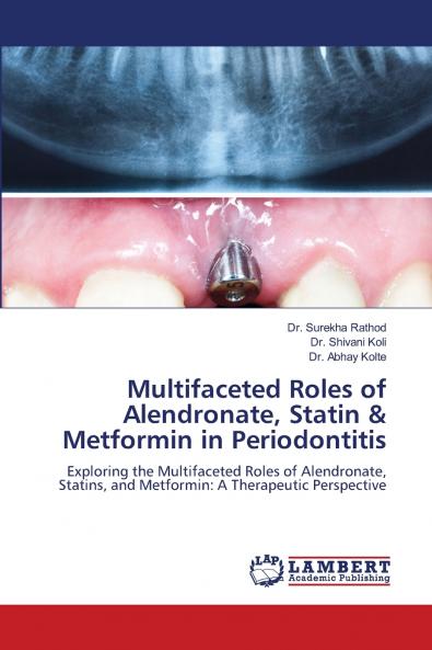 Multifaceted Roles of Alendronate Statin & Metformin in Periodontitis