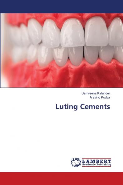 Luting Cements