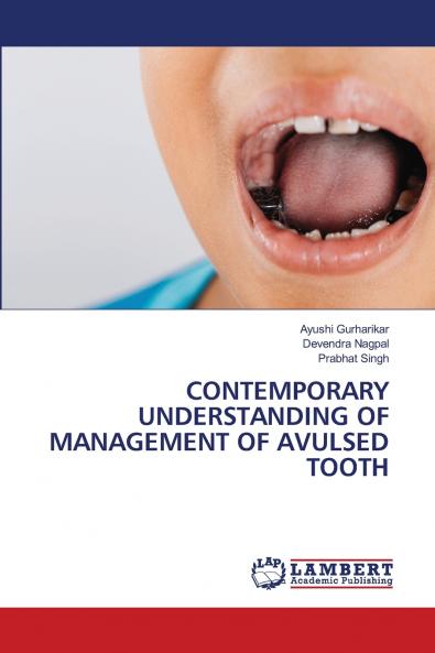 CONTEMPORARY UNDERSTANDING OF MANAGEMENT OF AVULSED TOOTH