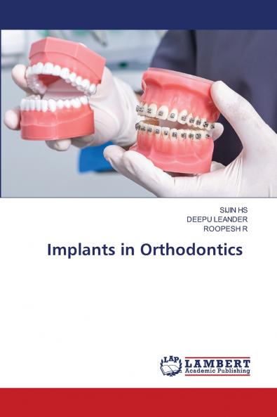 Implants in Orthodontics