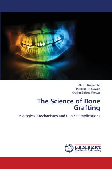 The Science of Bone Grafting