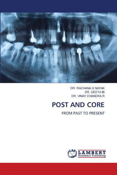 POST AND CORE